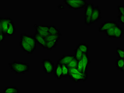 Immunocytochemistry/ Immunofluorescence - Anti-PFKFB2 antibody (AB234865)