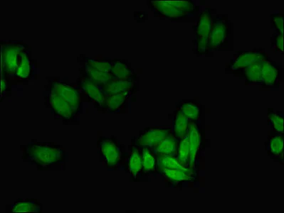 Immunocytochemistry/ Immunofluorescence - Anti-PFKFB2 antibody (AB234865)