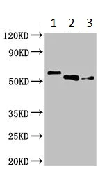 Western blot - Anti-PFKFB2 antibody (AB234865)