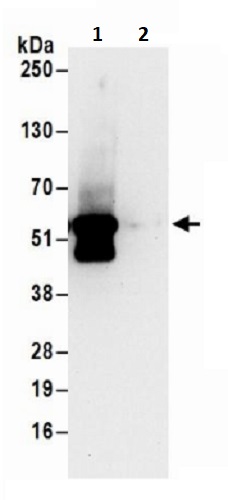 Immunoprecipitation - Anti-PFKFB2 antibody (AB241506)