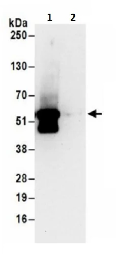 Immunoprecipitation - Anti-PFKFB2 antibody (AB241506)
