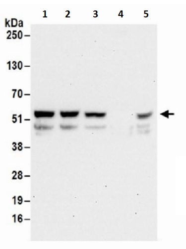 Western blot - Anti-PFKFB2 antibody (AB241506)