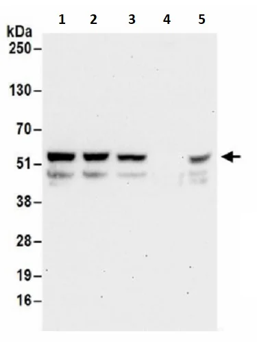 Western blot - Anti-PFKFB2 antibody (AB241506)