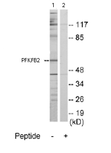 Western blot - Anti-PFKFB2 antibody (AB70175)