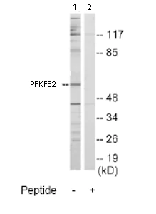 Western blot - Anti-PFKFB2 antibody (AB70175)