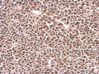 Immunohistochemistry (Formalin/PFA-fixed paraffin-embedded sections) - Anti-PFKFB3 antibody (AB96699)