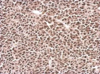 Immunohistochemistry (Formalin/PFA-fixed paraffin-embedded sections) - Anti-PFKFB3 antibody (AB96699)