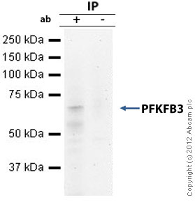 Immunoprecipitation - Anti-PFKFB3 antibody (AB96699)