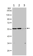 Western blot - Anti-PFKFB3 antibody (AB96699)