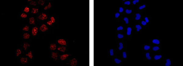 Immunocytochemistry/ Immunofluorescence - Anti-PFKFB3 antibody [EPR12594] - BSA and Azide free (AB218121)
