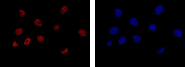 Anti-PFKFB3 antibody [EPR12594] - BSA and Azide free (ab218121