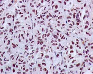 Immunohistochemistry (Formalin/PFA-fixed paraffin-embedded sections) - Anti-PFKFB3 antibody [EPR12594] - BSA and Azide free (AB218121)