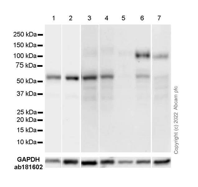 Western blot - Anti-PFKFB3 antibody [EPR12594] - BSA and Azide free (AB218121)