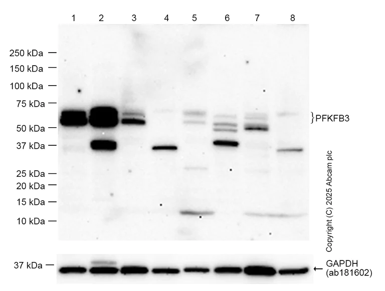 Western blot - Anti-PFKFB3 antibody [EPR12594] - BSA and Azide free (AB218121)