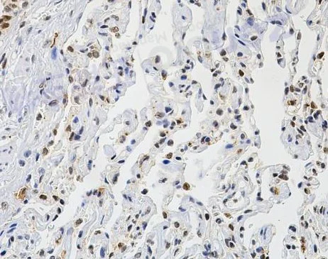 Immunohistochemistry (Formalin/PFA-fixed paraffin-embedded sections) - Anti-PFKFB3 antibody [SR3683] (AB326695)