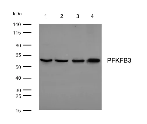 Western blot - Anti-PFKFB3 antibody [SR3683] (AB326695)