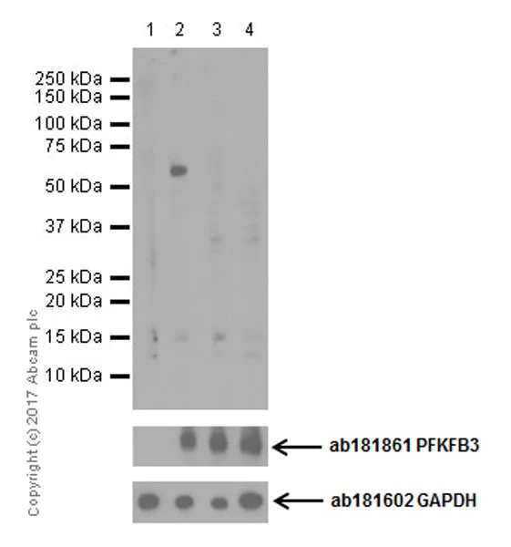 Western blot - Anti-PFKFB3 (phospho S461) antibody [EPR19735] - BSA and Azide free (AB232498)