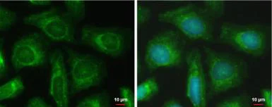Immunocytochemistry/ Immunofluorescence - Anti-PFKFB4 antibody (AB137785)