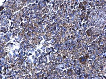 Immunohistochemistry (Formalin/PFA-fixed paraffin-embedded sections) - Anti-PFKFB4 antibody (AB137785)