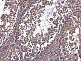 Immunohistochemistry (Formalin/PFA-fixed paraffin-embedded sections) - Anti-PFKFB4 antibody (AB137785)