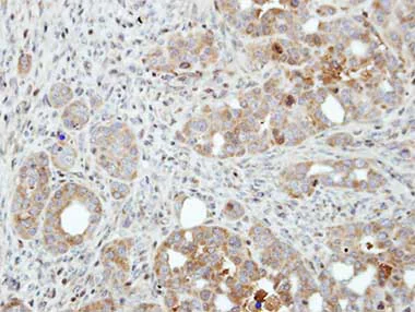Immunohistochemistry (Formalin/PFA-fixed paraffin-embedded sections) - Anti-PFKFB4 antibody (AB137785)