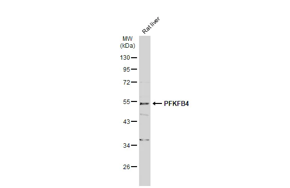 Western blot - Anti-PFKFB4 antibody (AB137785)