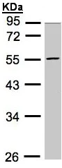 Western blot - Anti-PFKFB4 antibody (AB137785)