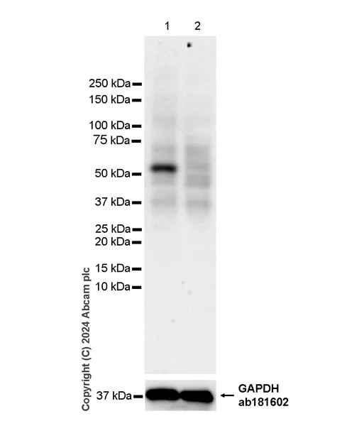 Western blot - Anti-PFKFB4 antibody [EPR28633-53] - BSA and Azide free (AB318194)