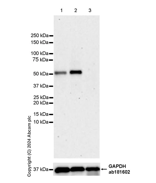 Western blot - Anti-PFKFB4 antibody [EPR28633-53] - BSA and Azide free (AB318194)