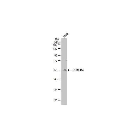 Western blot - Anti-PFKFB4 antibody [HL2204] (AB317160)