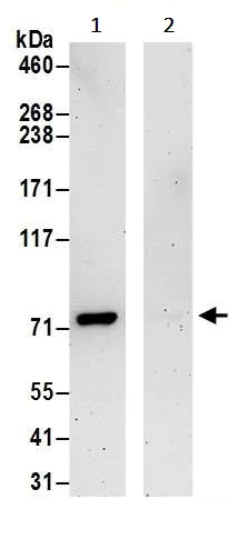 Immunoprecipitation - Anti-PFKL antibody (AB241093)