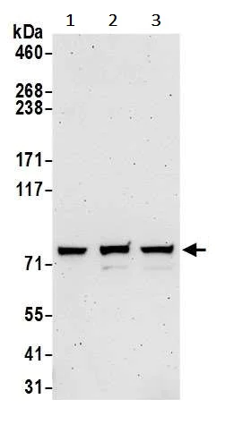 Western blot - Anti-PFKL antibody (AB241093)