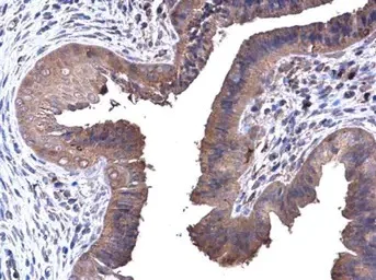 Immunohistochemistry (Formalin/PFA-fixed paraffin-embedded sections) - Anti-PFKL antibody (AB97443)