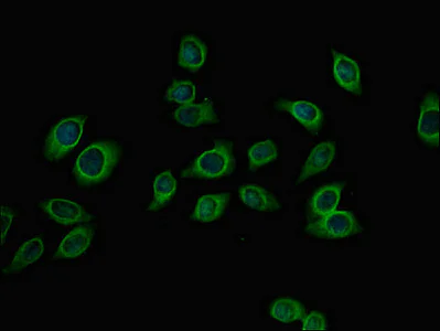 Immunocytochemistry/ Immunofluorescence - Anti-PFKM antibody (AB237545)