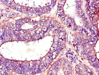 Immunohistochemistry (Formalin/PFA-fixed paraffin-embedded sections) - Anti-PFKM antibody (AB237545)