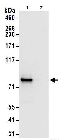 Immunoprecipitation - Anti-PFKM antibody (AB240754)