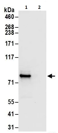 Immunoprecipitation - Anti-PFKM antibody (AB240754)