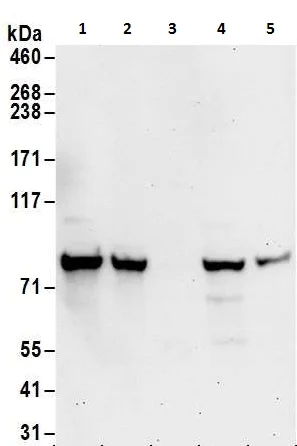 Western blot - Anti-PFKM antibody (AB240754)