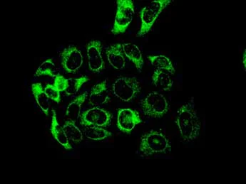 Immunocytochemistry/ Immunofluorescence - Anti-PFKM antibody [EPR10734(B)] (AB154804)