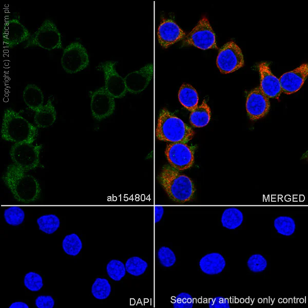 Immunocytochemistry/ Immunofluorescence - Anti-PFKM antibody [EPR10734(B)] (AB154804)