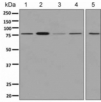 Western blot - Anti-PFKM antibody [EPR10734(B)] (ab154804), expandable thumbnail