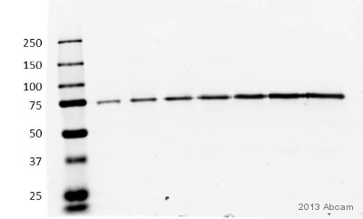 Western blot - Anti-PFKM antibody [EPR10734(B)] (ab154804), expandable thumbnail
