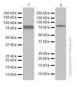 Western blot - Anti-PFKM antibody [EPR10734(B)] (AB154804), expandable thumbnail