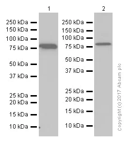 トップス ppfm lgb kmrii roen xfrm xff-coup.jpg?optimize=medium&