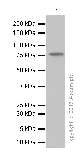Western blot - Anti-PFKM antibody [EPR10734(B)] (AB154804)