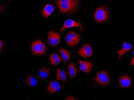 Immunocytochemistry/ Immunofluorescence - Anti-PFKM + PFKL antibody [EPR11904] (AB181064)