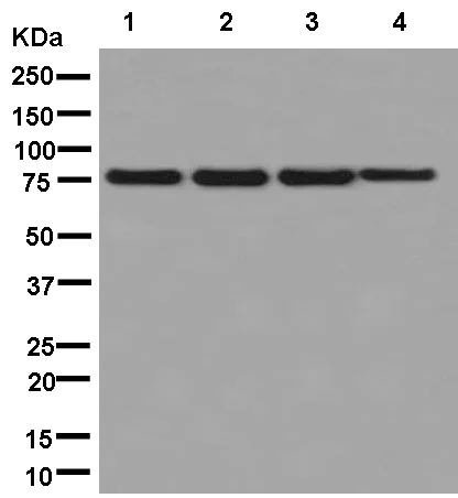 Western blot - Anti-PFKM + PFKL antibody [EPR11904] (AB181064)