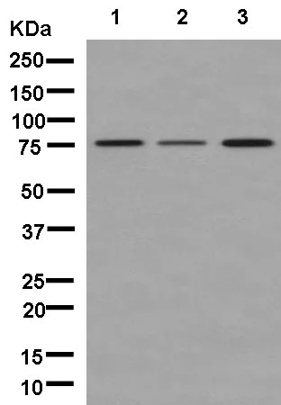 Western blot - Anti-PFKM + PFKL antibody [EPR11904] (AB181064)