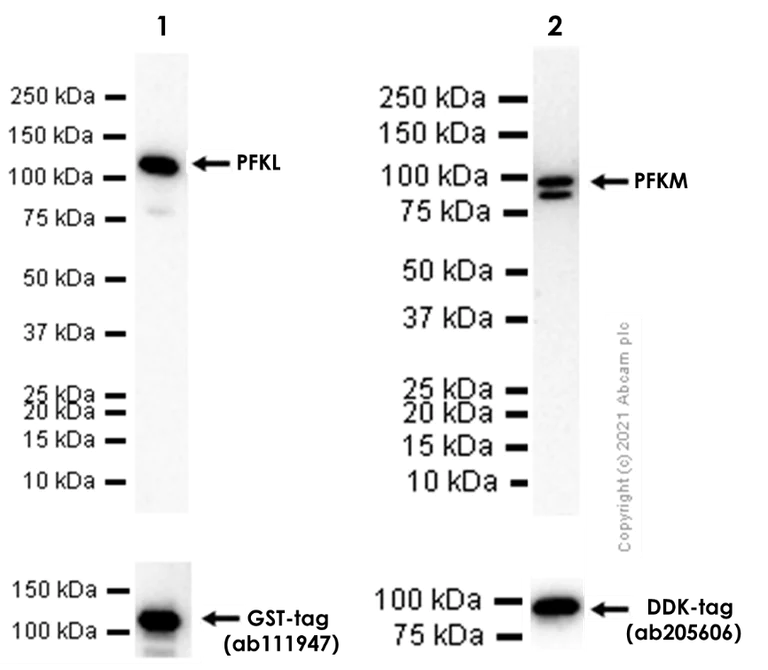 Western blot - Anti-PFKM + PFKL antibody [EPR11904] - BSA and Azide free (AB240237)