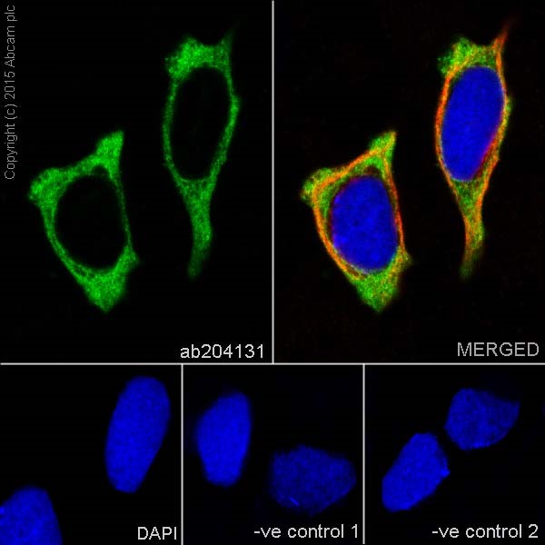 Immunocytochemistry/ Immunofluorescence - Anti-PFKM + PFKP antibody [EPR17314] (ab204131), expandable thumbnail